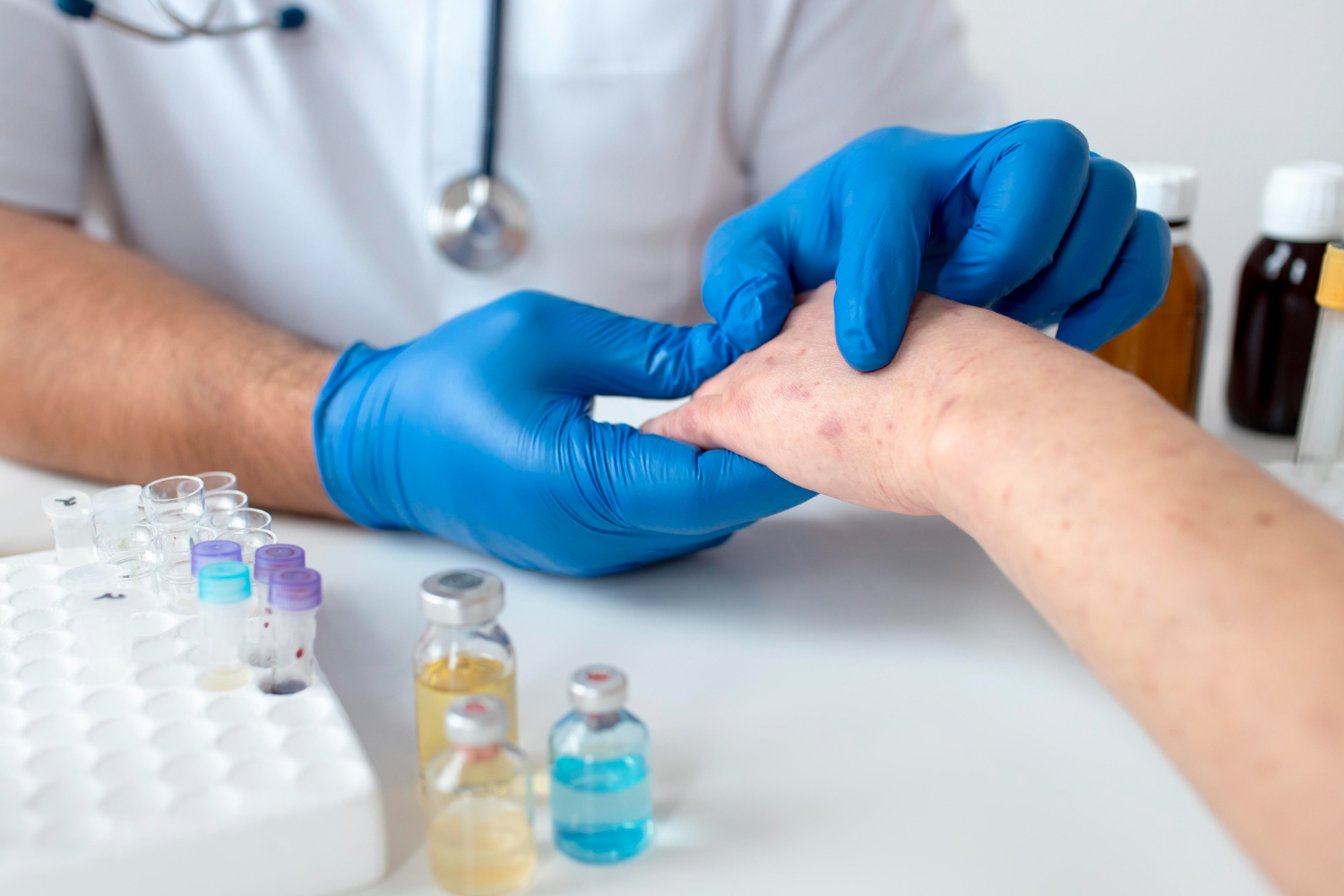 skin diseases